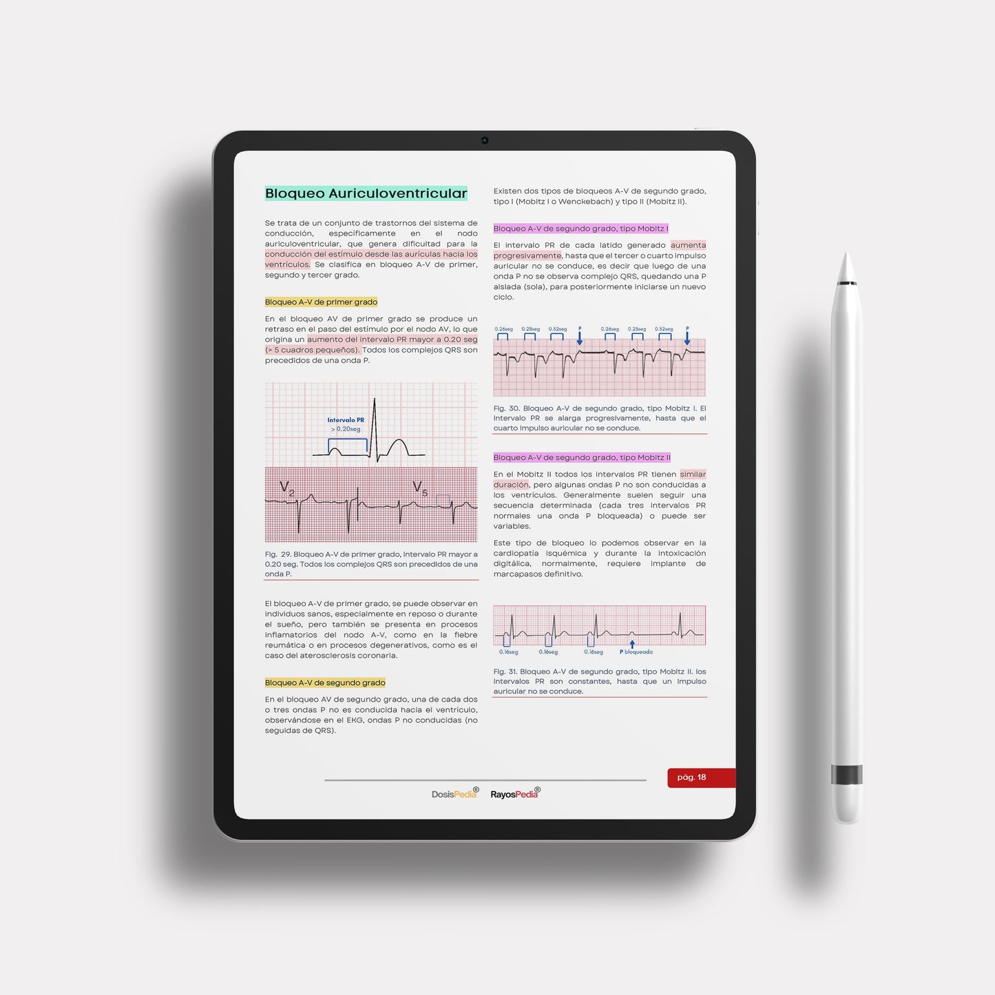Manual Practico de EKG