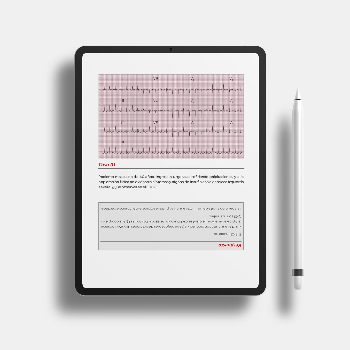 Manual Practico de EKG