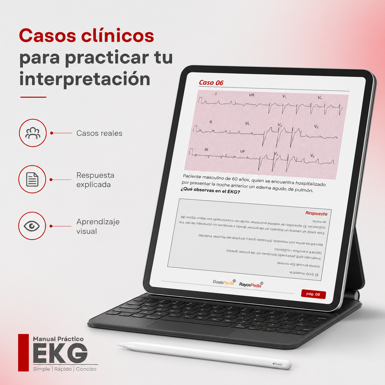 Manual Practico de EKG